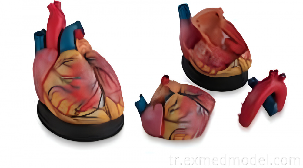 Büyütülmüş kalp anatomisi modeli Enlarged Heart Anatomy Model